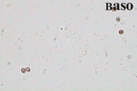 ��Һ�׼����^������øȾɫԇ���У����ױ�������