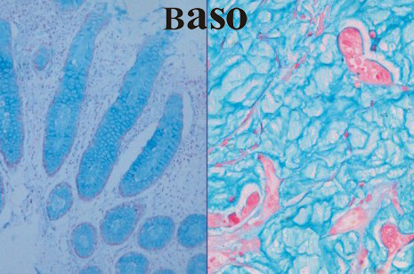 �����{��PH2.5��ȾɫҺ