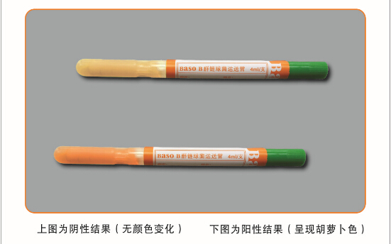 BȺ�����\�����B(y��ng)�ܣ�GBS��